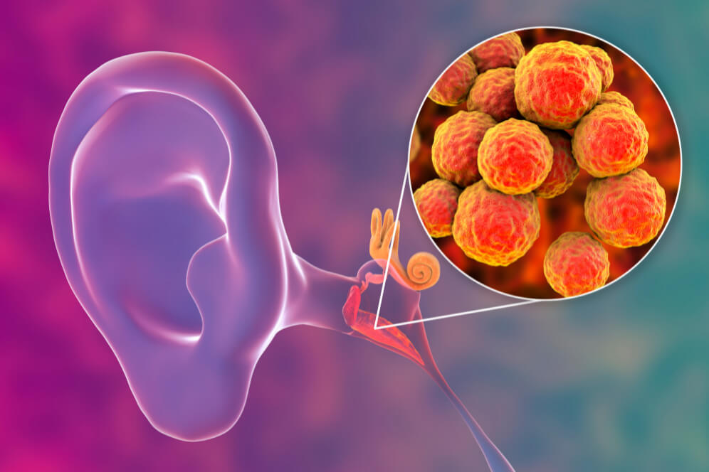 infectie bacteriana in ureche